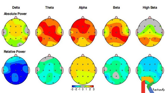Qeeg یا نقشه مغزی چیست؟ مجله روانشناسی رابینیا