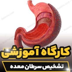 کارگاه آموزشی تشخیص سرطان معده